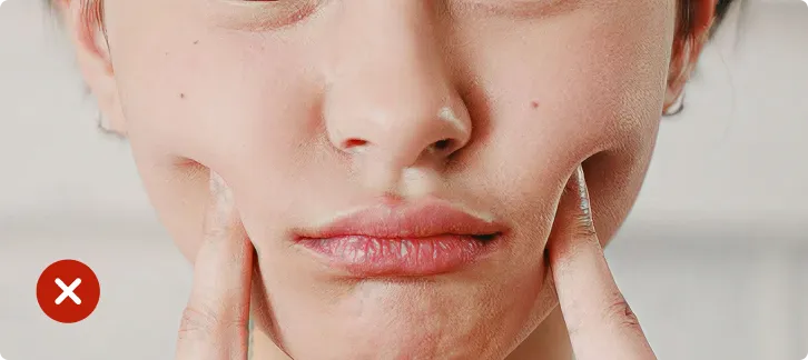 Close-up of a person's face with visible skin imperfections, using a skincare product.