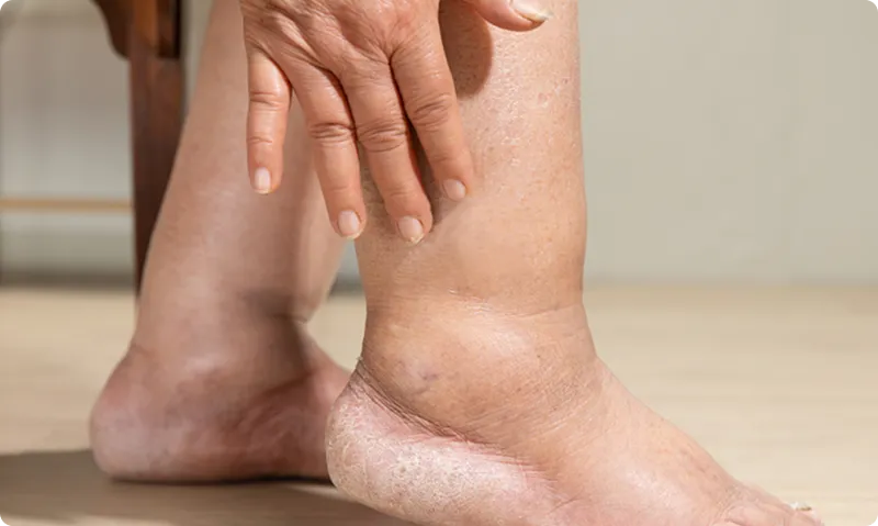 Close-up of a person's foot with visible veins, holding their ankle.