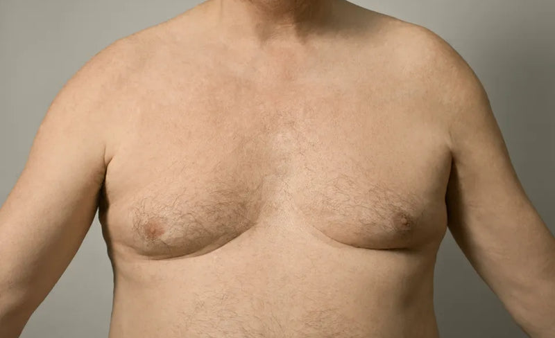 Partial view of a person's torso with visible hair and skin texture